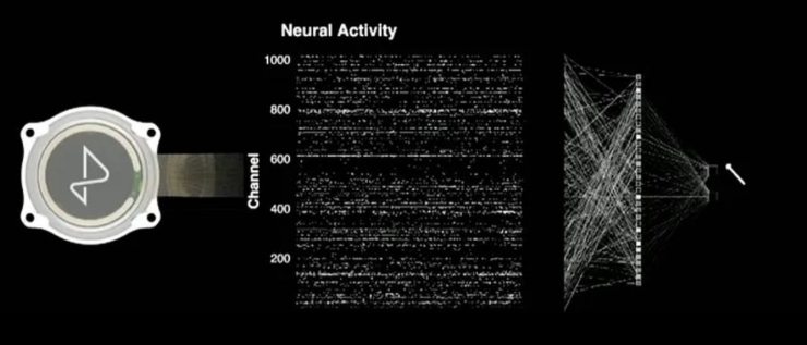elon musk ha impiantato il primo chip neuralink